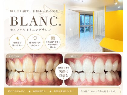 ブラン(BLANC.)の写真