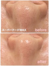 クイック(Quick)/スーパーフードフェイシャル