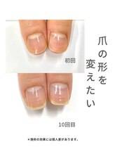 ブリエネイル/最強ネイルケア