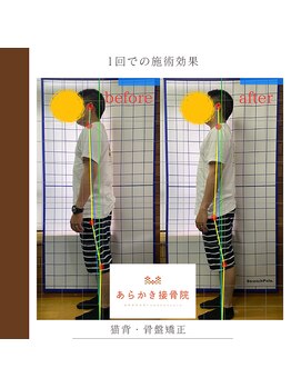 あらかき接骨院/【姿勢の変化】