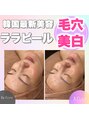 ホワイトアクア 天王寺本店(WHITE AQUA)&nbsp;ララピール/ピーリング/ハーブピーリング/ニキビケア/毛穴/小顔