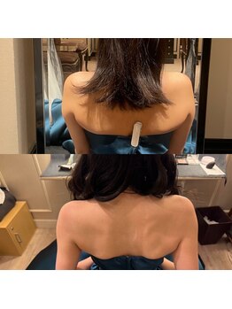 ハートエルボー(Heart elbow)/ブライダルのお客様