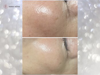 ノノサロン(nono salon)/