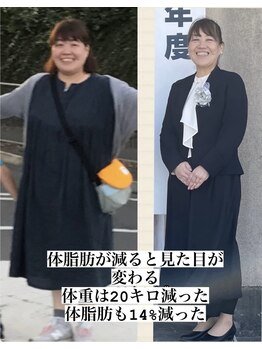 ヨサパーク ハット(YOSA PARK HAT)/劇的ビフォーアフター