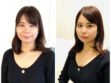 ジブンビューティー(jibun beauty)/ビフォーアフター