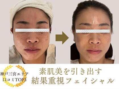 パルタージュ 三宮(Partage)の写真