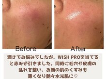 ブルーム(BLOOM)の雰囲気（敏感肌・年齢肌・乾燥肌等、様々なお悩みに丁寧にアプローチ。）