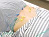 【つらい痛みの緩和に】電気鍼施術30分 ¥3200