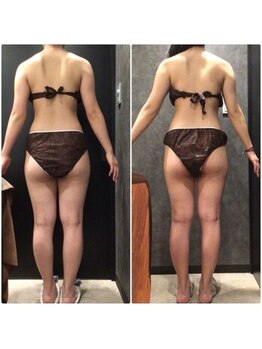 フローボディ 新山口店(flow BODY)/山口のエステはflow BODY