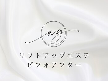 アストリエ グレース 相模大野(Astorie Grace)/フェイシャルビフォアフター♪