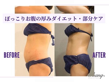 サンク(Thanq)/筋肉太り・脂肪太りケア