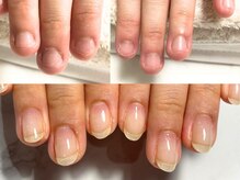 アリエ(allie)の雰囲気（自分を好きになるきっかけ＝深爪矯正/いつからでも変われる体験）