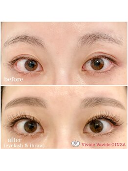 ビビデバビデ(Vivide Vavide)/【マツエク】眉とまつ毛同時施術