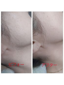 銀色の鏡/横顔の産毛もスッキリ綺麗に♪