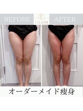 ルルアス 銀座(LuLuAS)/即効性抜群の６種マシン