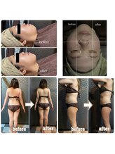 ラクラク(rakuraku)/【痩身＆小顔リフトアップ】