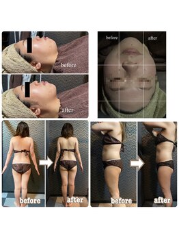 ラクラク(rakuraku)/【痩身&小顔リフトアップ】