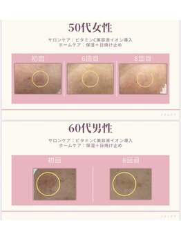 ペルレ(Perle)/50代女性／60代男性