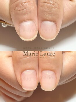 マリーロール 梅田店(Marie Laure)/深爪改善/自爪育成/ネイルケア