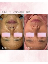 ソワイユ 浜松店(Soyeux)/テラボーラー　before→after