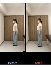 GWRいこい整体院/【猫背　Before After】　