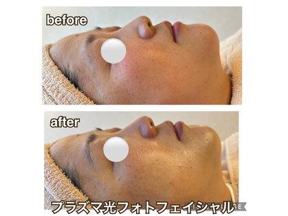 プライベートサロン サイ(sai)の写真