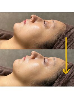 ベラノーブル(bella noble)/初めての方も是非!!