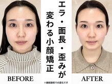 ザ リフト カドモリ 鹿児島 霧島(The Lift KADOMORI)