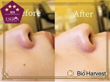 ビオハーヴェスト 日立駅店(Bio Harvest)の雰囲気（毛穴汚・たるみ改善・小顔実感◆熟練ハンド技術◆マシン速攻効果）