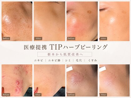 ジュパール(je pars)の写真