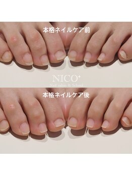 ニコプラス(NICO+)/足のお手入れできていますか?