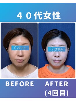 ぐっすりん/複数回継続のお客様の変化(5)