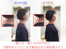 タイナ 岡山(taina)/猫背・巻き肩矯正