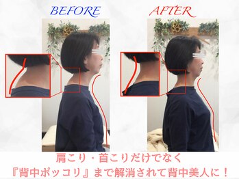 タイナ 岡山(taina)/猫背・巻き肩矯正