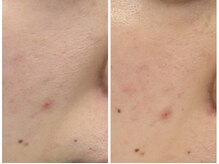 ルリアン(Le lien)/新メニュー！プラズマ◎