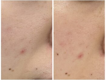 ルリアン(Le lien)/新メニュー!プラズマ◎