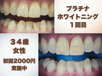 セルフダック 京都長岡京店