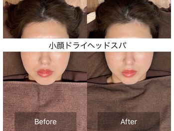 ラヴァンド(Lavande)/【小顔ドライヘッドスパ 症例】