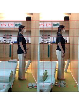 よし鍼灸接骨院 南堀江院/骨盤矯正/マッサージ整体/鍼灸