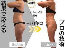 ジャパ(JAPA)