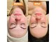 ラタビューティーヒラツカ(RataBeauty Hiratsuka)の写真
