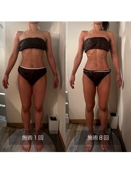 フィエルテ 甲斐敷島(FIERTE)/Before after