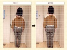 ルクラ(Lucura)/歪み改善で背中すっきり