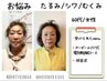 【たるみ/乾燥肌/しわ】 引き上がったぷるぷる肌へ　美容鍼(70本)×超音波　
