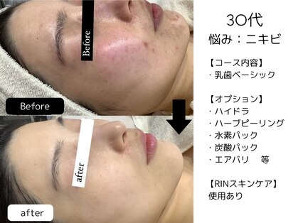 リンフェイス 表参道(RIN FACE)の写真