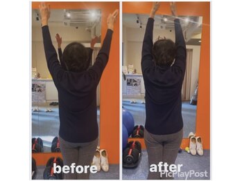 カワル整体 上通り院/50肩は放っておいても良いのか