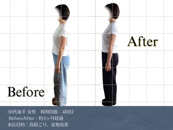 リビット 等々力(Rebit)/BeforeAfter,姿勢調整,首肩こり
