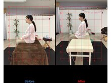 ストレチックス 近江八幡店/首・肩に痛みがあった女性