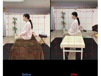 ストレチックス 近江八幡店/首・肩に痛みがあった女性