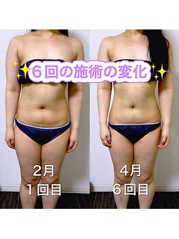 エステサロンクオーツ/上半身コース